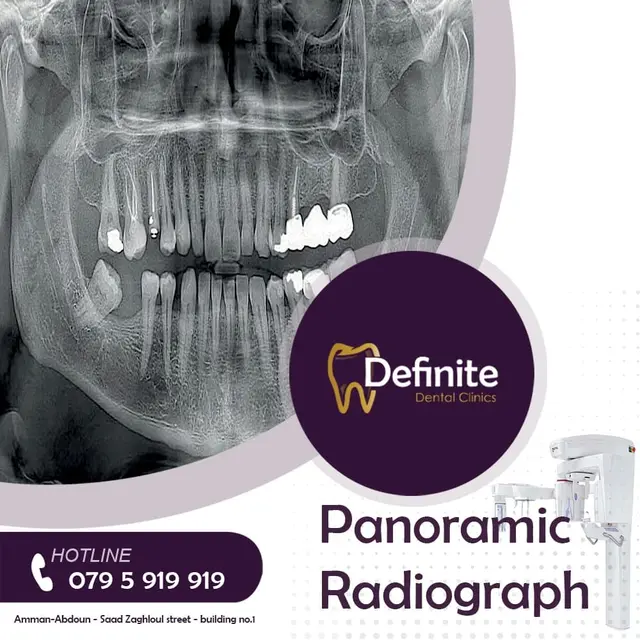 X-Rays