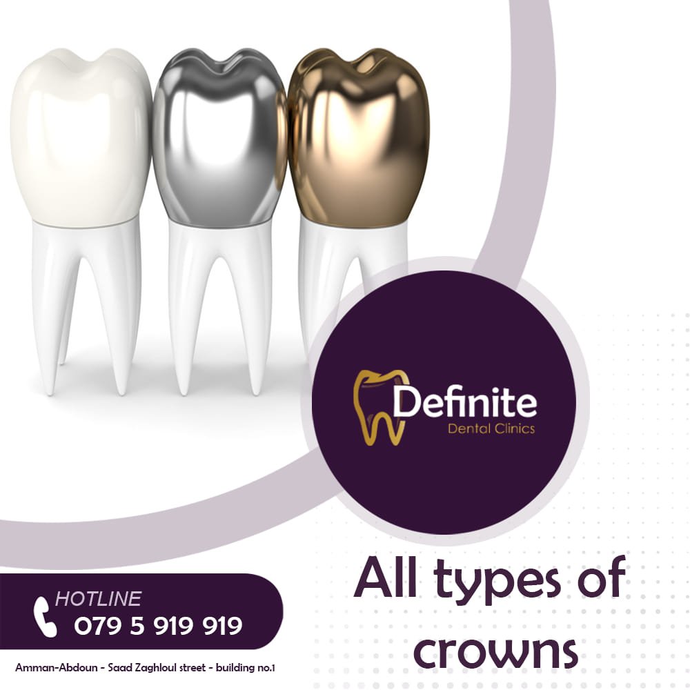 Crowns